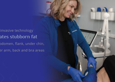 Patient receiving CoolSculpting Elite to eliminate stubborn fat from NeoSkin Medical Spa in Hudson Ohio