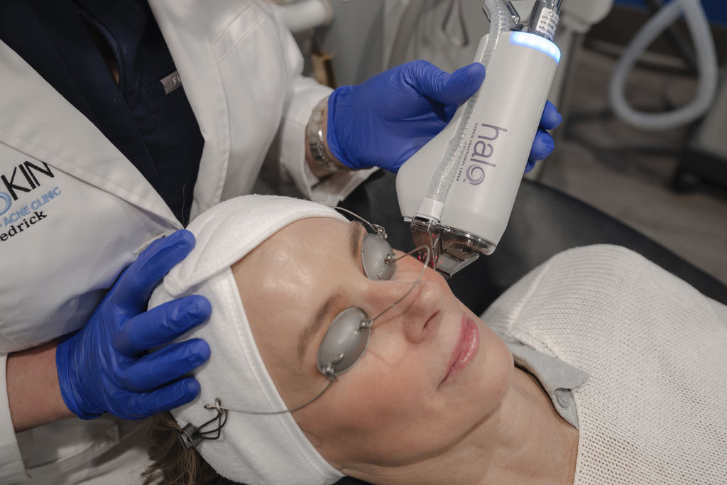 Collagen Stimulaters & Skin Rejuvenation from NeoSkin Medical Spa in Hudson Ohio