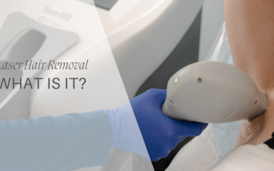 Laser Hair Removal: What is it?